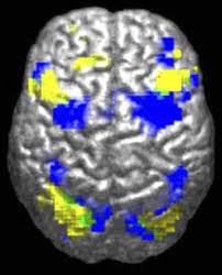 Human brain